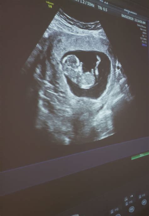 pregnant ultrasound porn|'pregnant ultrasound' Search .